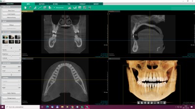 CT-3D diagnostics at Nádor Dental